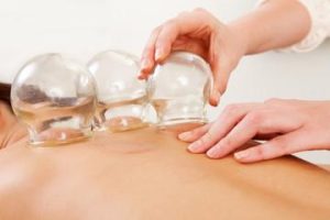 cupping therapy at womens health collaborative